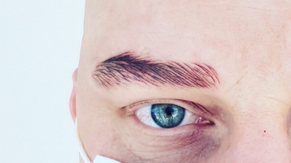 Dermopigmentazione Alopecia