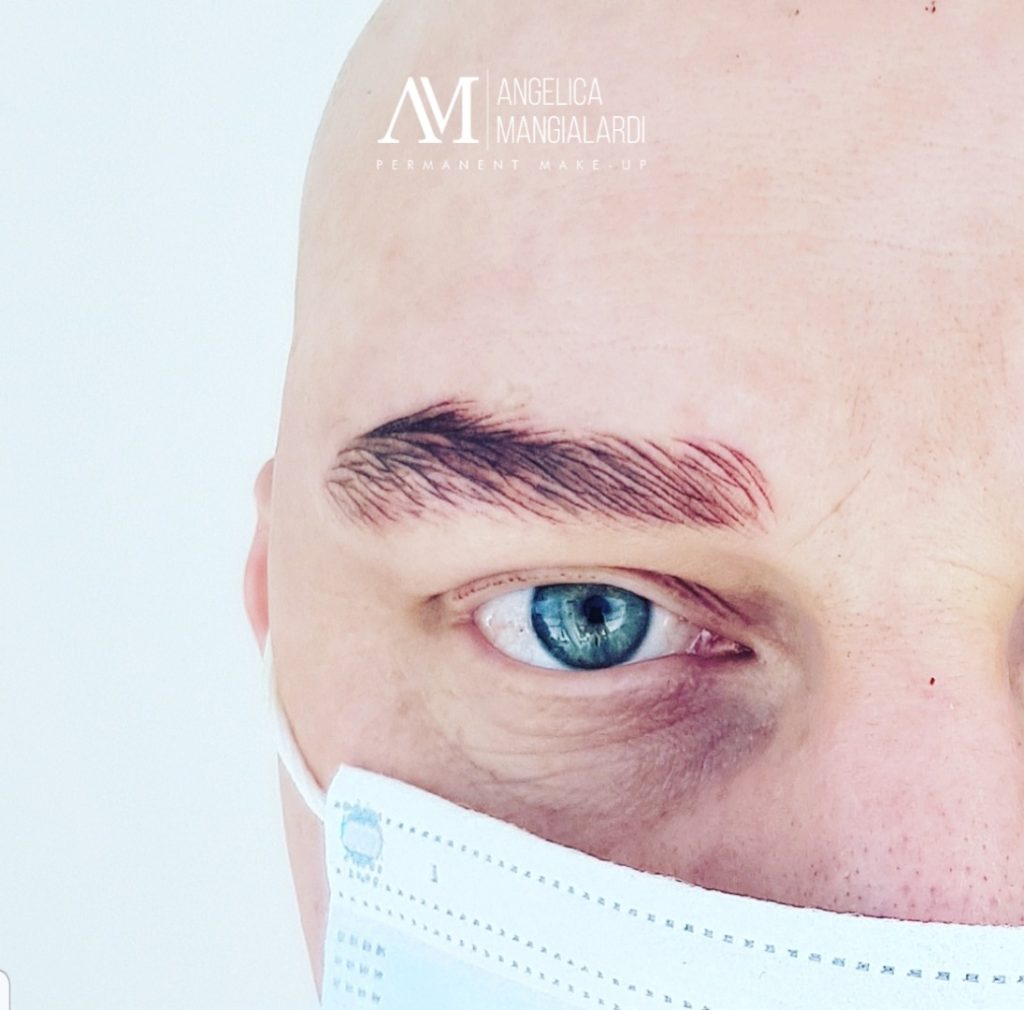 Dermopigmentazione Alopecia