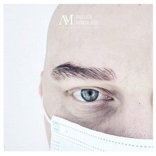 Corso Di Dermpigmentazione Su Alopecia
